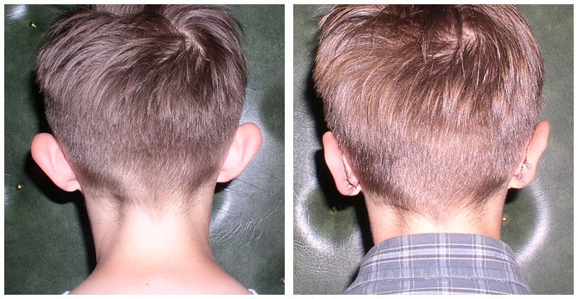 002-002-ear